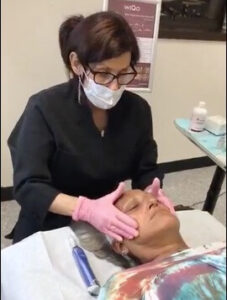 Person applying PRX-T33 to skin