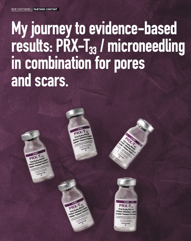My journey to evidence-based results. PRX-T33 / Microneedling in combination for pores and scars
