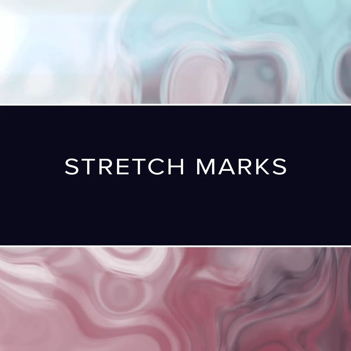 Plasma Advanced Training: Online Individual Course - Stretch Marks